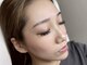アイクチュール(ai couture)の写真/アイブロウと一緒にフェイスWAXがおすすめ＊顔脱毛で産毛や角質が取れて透明感ある憧れのつるつる卵肌に♪