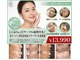 多穏スキンケア(skin care)の写真/【毛穴・シワ改善】サーマルフラクショナルで真皮のハリが肌を育て、表皮をクリアに明るく透明に♪