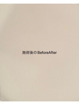 トトノエル(TOTONOEL)/BeforeAfter