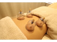 リライフ(Relife)/カッピングで老廃物とおさらば♪