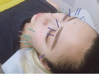 北越谷みんなの鍼灸整骨院/目元・口元のお悩みにアプローチ