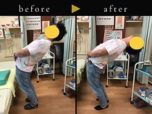 杉本接骨鍼灸院/若々しい背骨を取り戻す整体