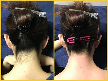 クラウン ジュエルズ(CROWN JEWELS)/【Wax脱毛】うなじ 正面 1