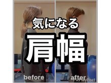 カワル整体 上通り院/肩幅気になる人