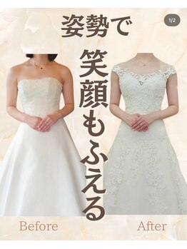 亀田ここらく整骨院 整体院/「肩の高さ」違っていませんか？