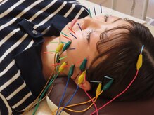 中洲美容鍼灸院 福岡博多院/電気鍼でさらに小顔に