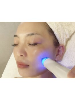 小顔になりたい