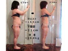 痩身 セル脂肪専門 スタイルデザイン