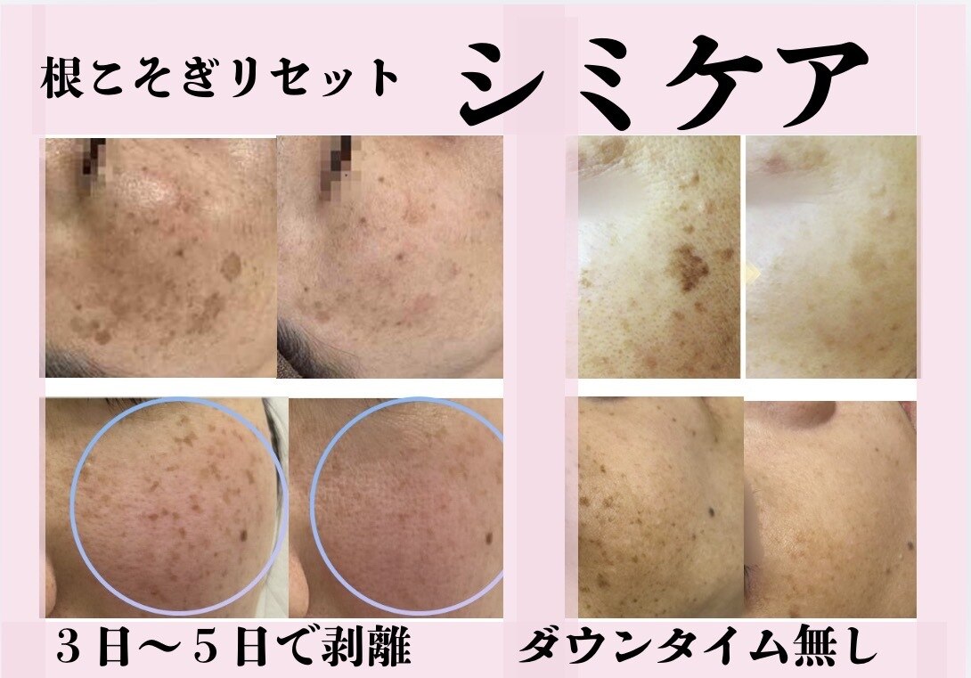 ルナさま専用ページ ルナ(Luna)｜ホットペッパービューティー