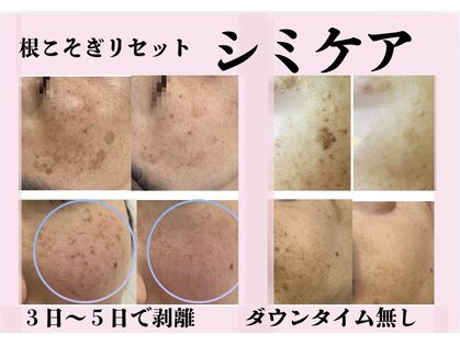 ルナ(Luna)の写真