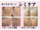 ルナ(Luna)の写真