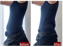 岩田整骨院美容整体院/【トランスビート】寝るだけ痩身