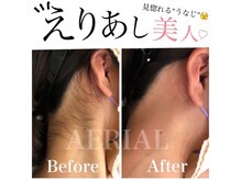 エアリアル 大川店/えりあしbefore after