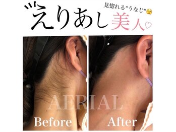エアリアル 大川店/えりあしbefore after