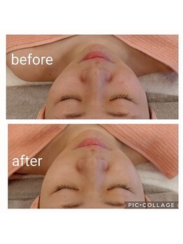 ラ ヴィ リッシュ(La vie riche)/お顔には一切触れていません(^^)