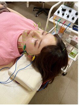 まごころ整骨院/効果◎！！電気美容鍼