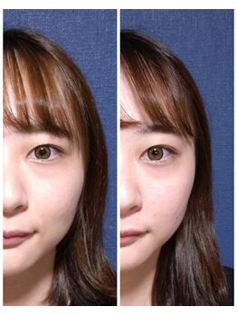 ぐっすりん/複数回継続のお客様の変化(2)