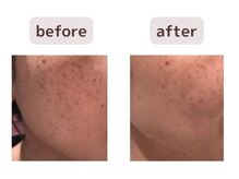 リジェネラティブセル メディカルサロン(Regenerative Cell Medical Salon)/ビフォーアフター