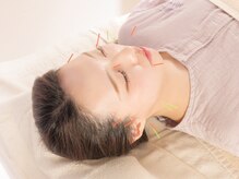 ビハリスト 麻布十番/美容鍼