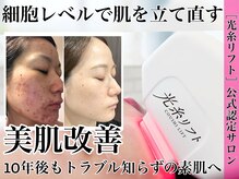 クレール 新松戸(Claire)の雰囲気（リフトアップ小顔で若々しい見た目/新松戸で小顔や毛穴ケアなら）