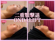 マヤヒメ(mayahime)の雰囲気（オンダリフト骨格に合わせた施術でお気に入りのフェイスラインへ）