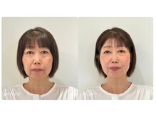 スタイルキューピット(style cupit)/メイクビフォアフター＊50代
