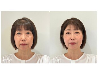 スタイルキューピット(style cupit)/メイクビフォアフター＊50代