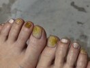 yellow nuance/foot design