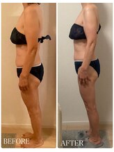 イリゼ(IRISER)/【60代痩身】3ヶ月の結果