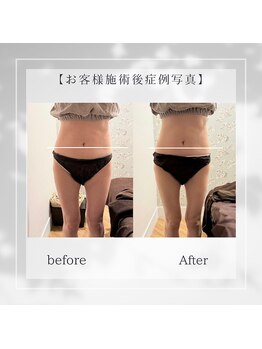 27コスメ銀座/【NEW】筋膜リリースお試し60分