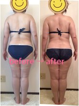 ビューティー サロン ハナ(Beauty Salon hana)/骨格ボディメンテ5回