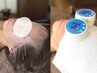 ★【眼精疲労に◎】ルート鍼+水素灸+頭・目元のコリほぐし30分通常¥8000
