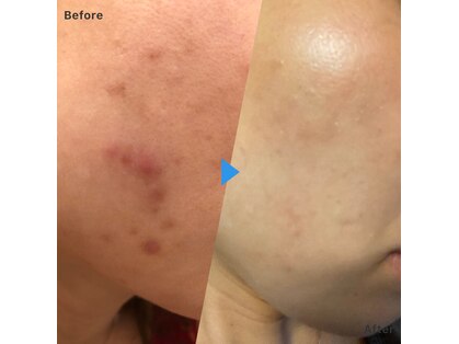 ミロク 伏見桃山店(miroku)の写真