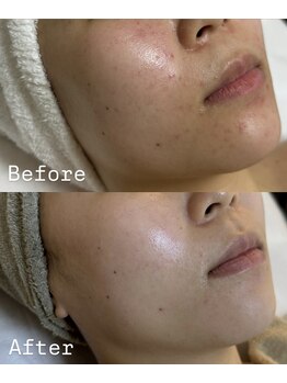 アテ(Ate)/揺るがない美肌作りでお肌強化