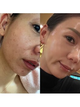 モアナ(Moana)/ホームケアも充実