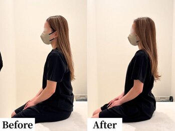 ソレア(Solea)/巻き肩改善1回目