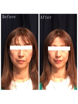 たくろう鍼灸院 豊田本院/Before&After