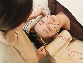 フィル(fill)の写真/美肌を目指せるサロンで、たるんできたと思ったら美容鍼！年齢によるたるみにアプローチ◎