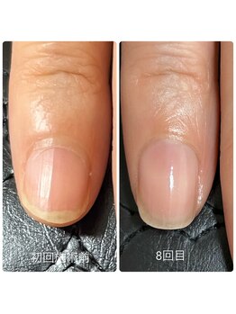 ルミライズ(Lumirise)の写真/【爪のピンク部分をのばし縦長爪へ】ジェルを使わず土台から美しく整えるケアサロン♪