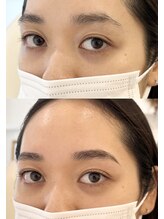 ブルーアイズ トウキョウ(BLUE EYES)/eye＋eyebrowで整う目元
