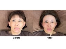 こじま 富雄団地接骨院/Before&After