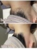 大人女性へ！《意外と見られるパーツNo1！/うなじホワイトニング》7980→6000