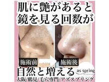 アズ スプリング(as spring)の雰囲気（毛穴に特化したエステ。フェイシャルマッサージ生パックも好評）