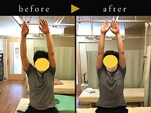 杉本接骨鍼灸院/若々しい背骨を取り戻す整体