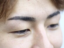 ハリウッドブロウリフト