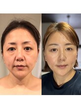 トゥインクル(Twinkle)/ダウンタイムなし！