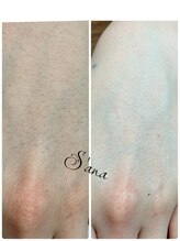 サナ 久が原 千鳥町(S’ana)/ハーブピーリング