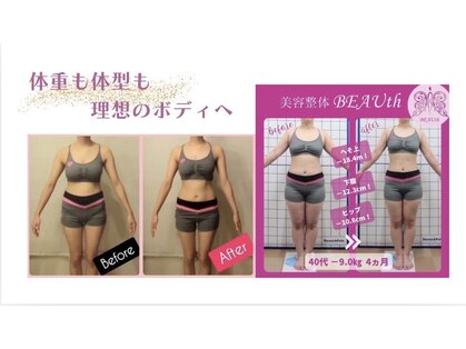 美容整体 ビュース(BEAUth)の写真