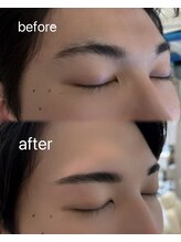 ビュー テンジン 天神 大名(VIEW TENJIN)/アイブロウ・WAX脱毛