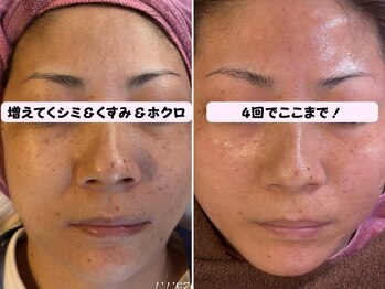 ココネイル(coco.nail)/